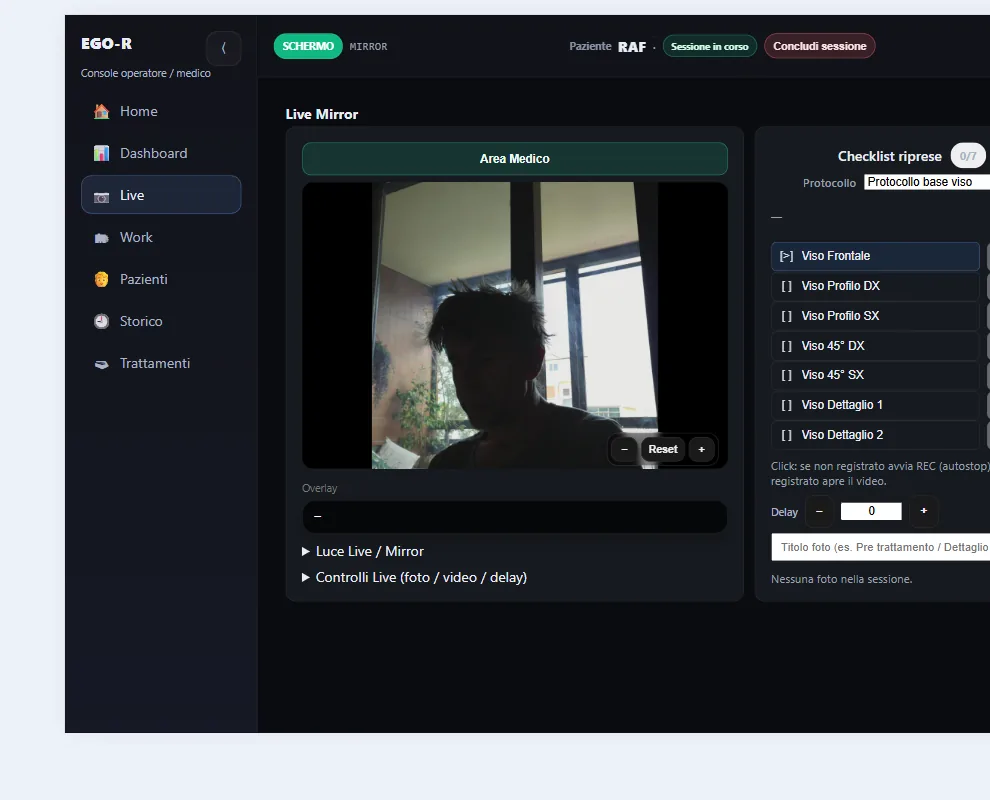 Acquisizione live da console tablet