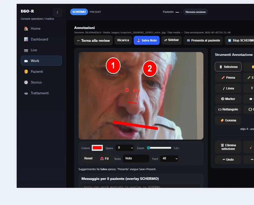 Annotazioni su immagine per confronto