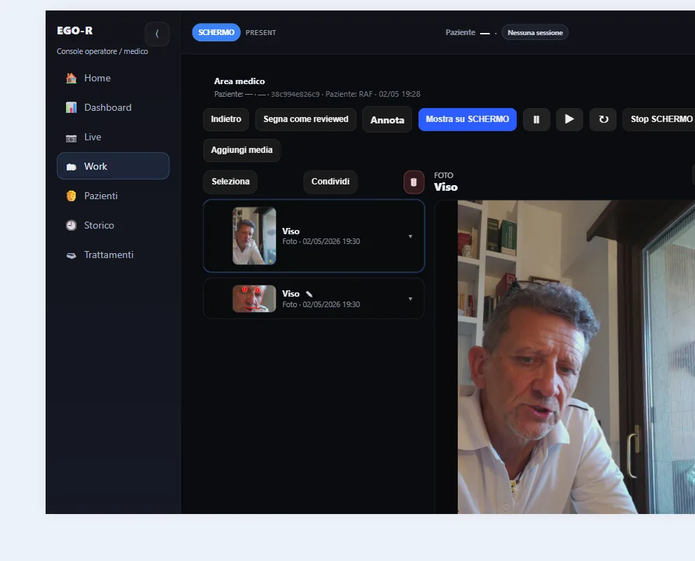 Live e acquisizione media in sessione